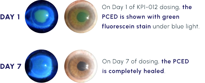 day 1 and day 7