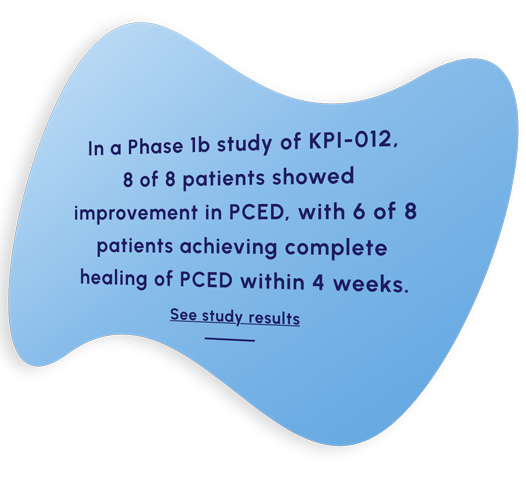 In a Phase 1b study of KPI-012, 8 of 8 patients showed improvement in PCED, with 6 of 8 patients achieving complete healing of PCED within 4 weeks.